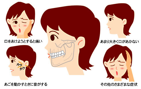 咬合治療 宮城県大崎市古川の三塚歯科クリニック 咬合治療 宮城県大崎市古川の三塚歯科クリニック