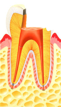 虫歯の治療｜三塚歯科クリニック